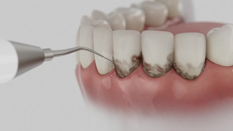 Trusted Dental Crowns And Bridges service in Guymon, OK - Dentist Open Now